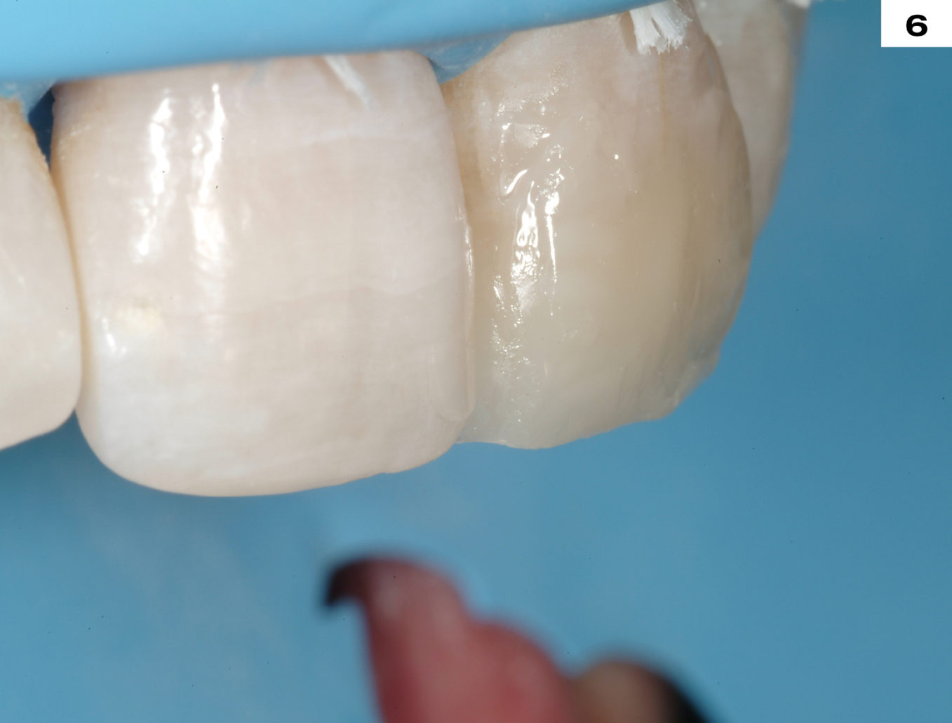 COMPOSITE edelweiss dentistry products GmbH