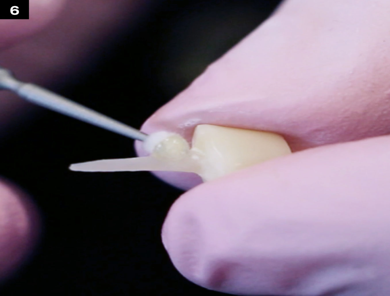 POST & CORE edelweiss dentistry products GmbH